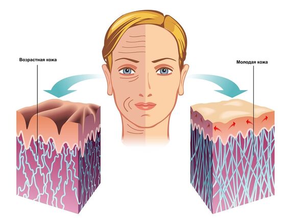 Какой вид коллагена бывает и как выбрать подходящий