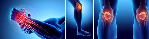 Какой тип коллагена нужен для суставов и хрящей?